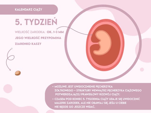 Czy w 5 tygodniu lekarz potwierdzi ciążę? Sprawdź, co warto wiedzieć Czy w 5 tygodniu lekarz potwierdzi ciążę? Sprawdź, co warto wiedzieć