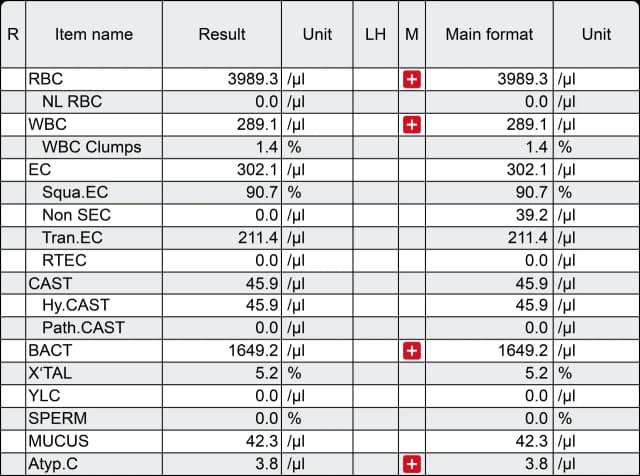 Czy badanie moczu wykryje raka? Sprawdź, co może ujawnić analiza moczu Czy badanie moczu wykryje raka? Sprawdź, co może ujawnić analiza moczu